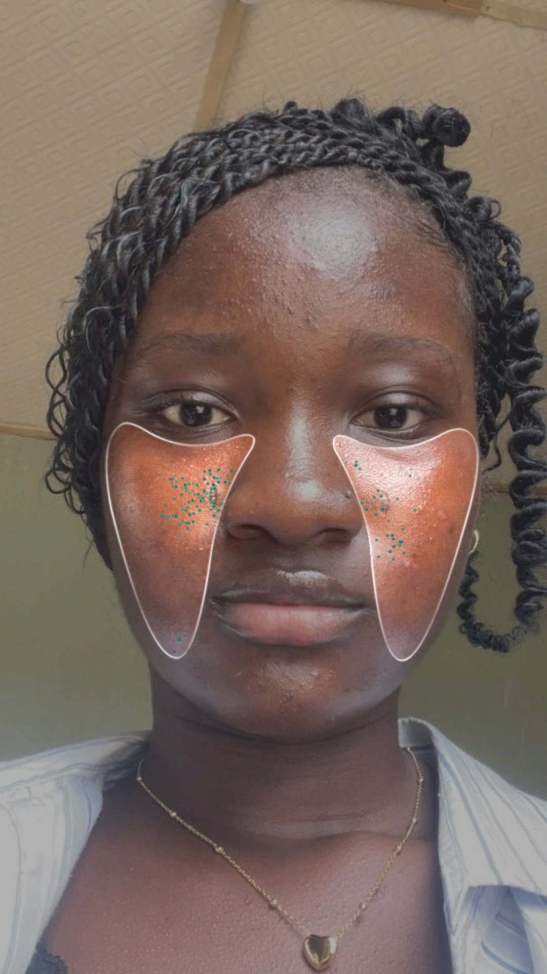 Analyse Pores — Joues